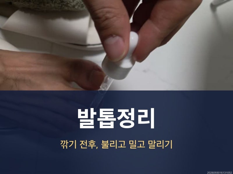 발톱정리 깎기 전후 루틴, 불리기부터 줄질과 도구 관리까지