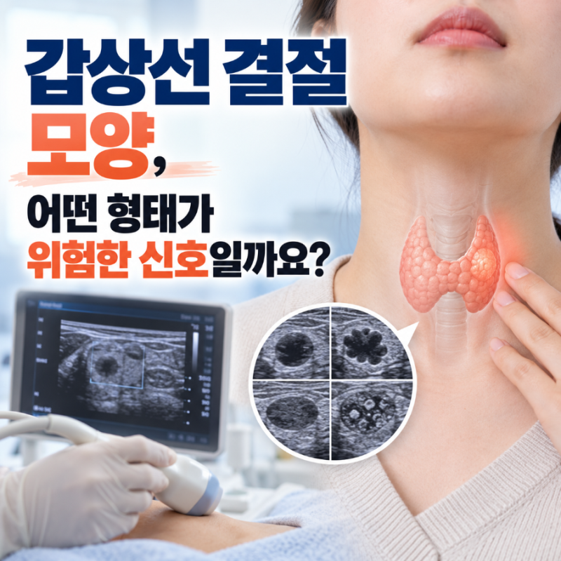 갑상선 결절 모양, 어떤 형태가 위험한 신호일까요?