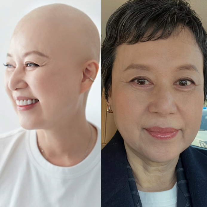 죽었다는 소문까지... 박미선 유방암 근황, 1년 투병 후 복귀 서두른 이유