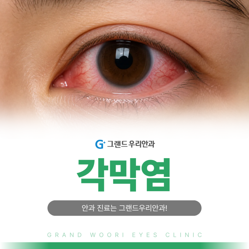 석사동안과 각막염 원인 증상 관리법 총정리합니다