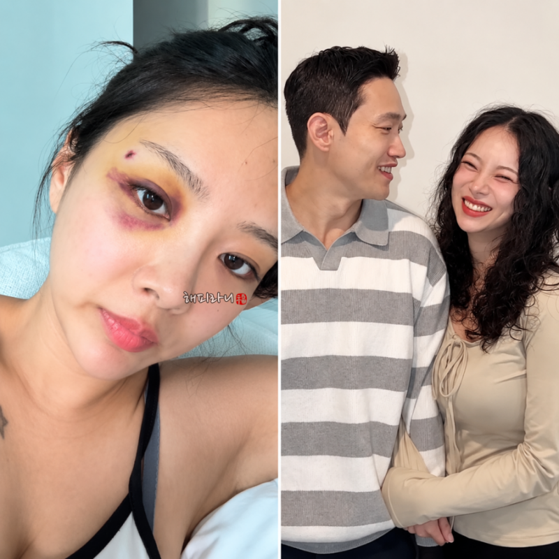 10기 옥순 김슬기 이혼설보다 더 충격적인 결혼식 한 달 남겨놓고 눈탱이 밤탱이 무슨 일?