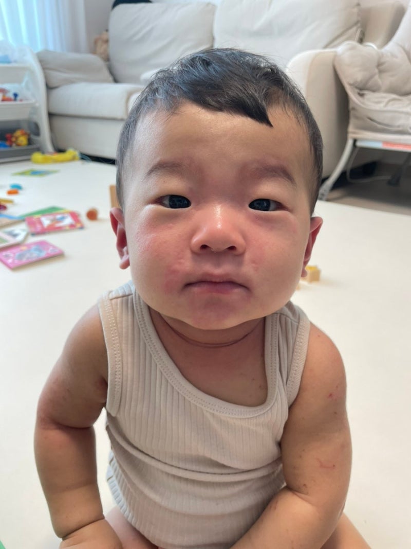 돌, 두돌아기 식품 알러지 관리중이에요(밀가루, 계란, 마늘)땅콩잼으로 알러지 테스트하지 ....