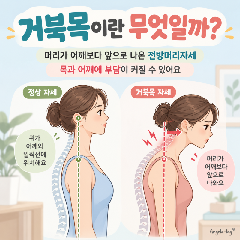 “목이 앞으로 나왔다면?” 거북목 증후군 원인부터 증상·교정 운동·병원 가야 할 때까지 ....