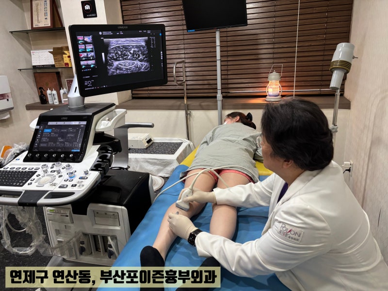 부산하지정맥류 약물치료 전 알아야 할 단점과 부작용