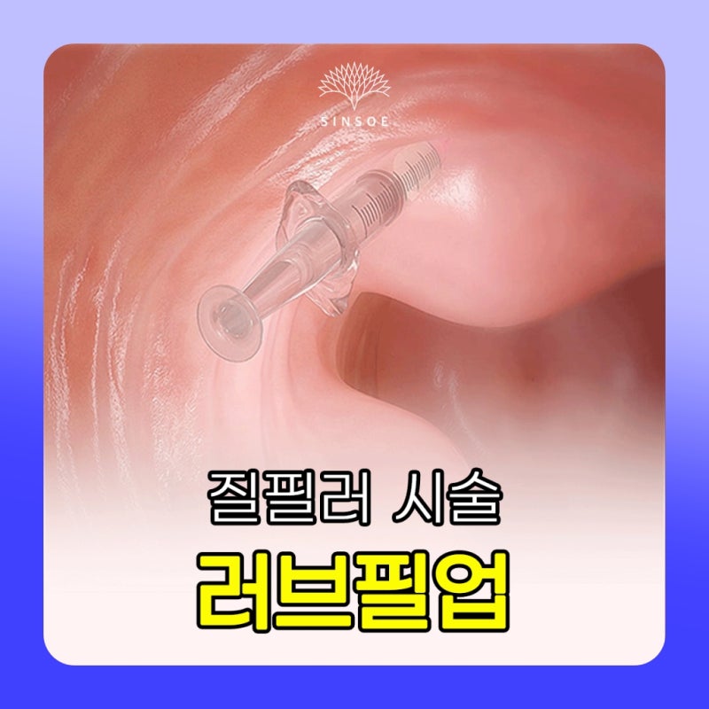 출산 후 질 필러를 알아보고 있다면, 후기보다 먼저 확인할 것들