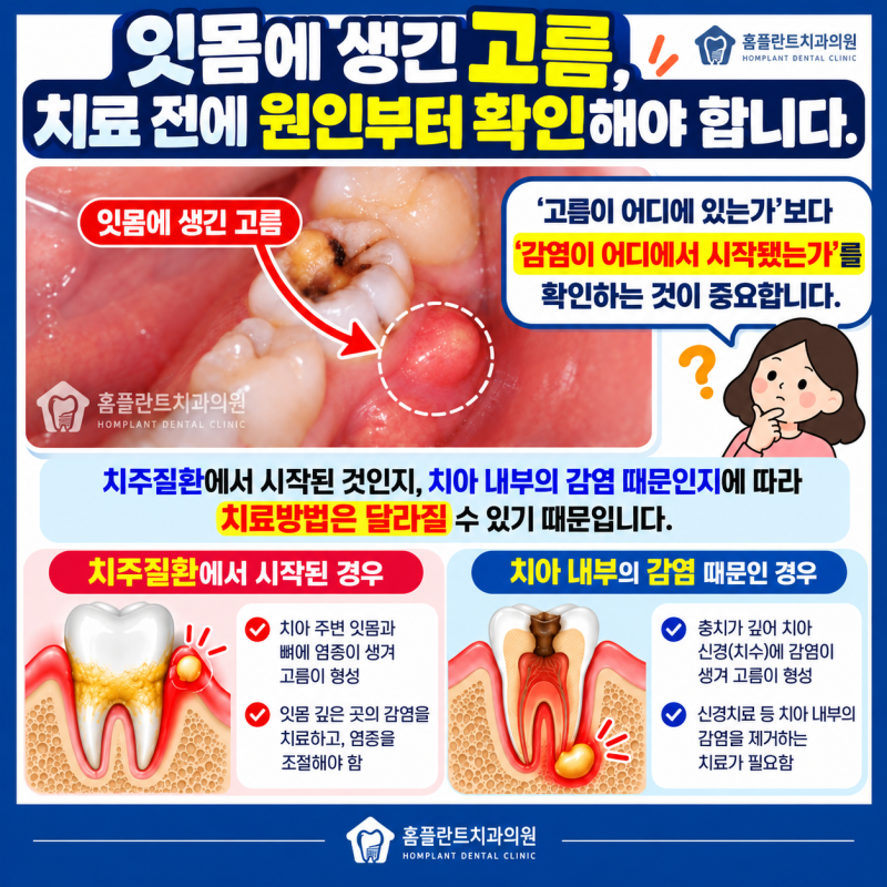 잇몸에 고름이 생겼어요. 원인은 무엇이고 어떻게 치료하나요?
