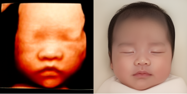  임신 7개월) 23주~27주 태교여행, 입체초음파, 당근