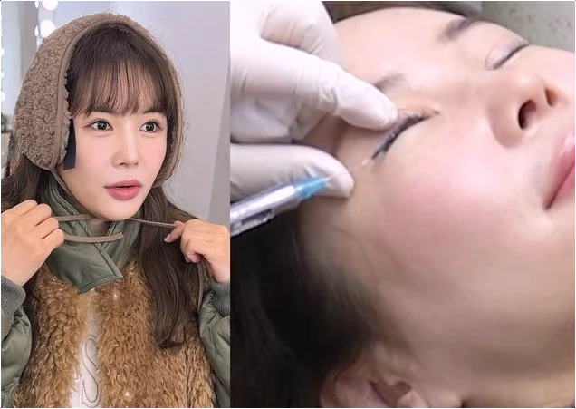  장영란 아이라인 문신 제거 후기 48세에 15살 어려진 비결 공개!