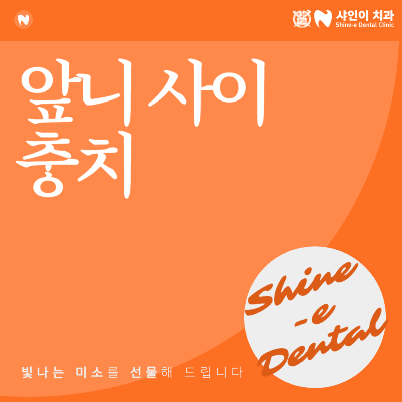 천안 성정동 치과 앞니 사이 충치 초기 증상, 아프지 않아도 절대 넘기면 안 되는 이유