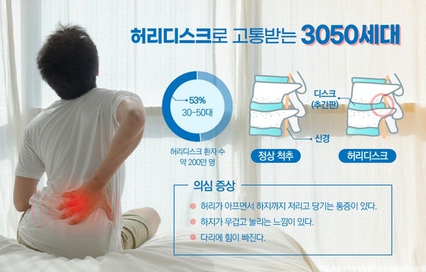 극심한 허리디스크 터짐 통증 생존기[3] (자연치유 효과 200% 허리디스크 스트레칭, 신경성형....