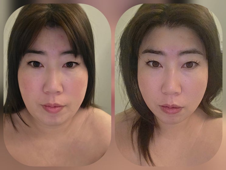  [장유율하]무너진 얼굴선 리셋해주는 장유 윤곽관리 '고운빛깔에스테틱 김해장유점'