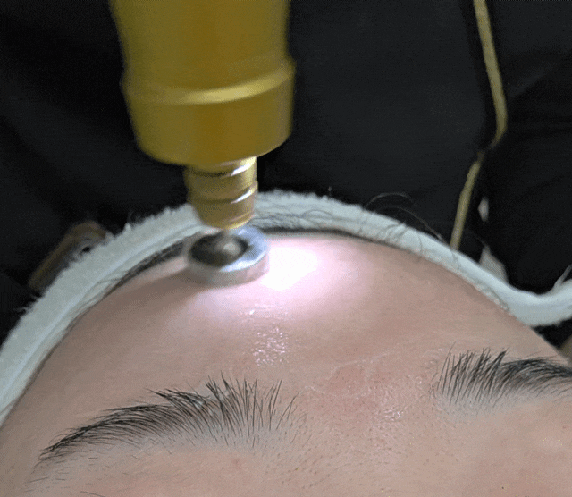  더스무스송도 피부관리 에스테틱 다운타임없는 역노화 관리방법 플라즈마 상세후기 더스무스