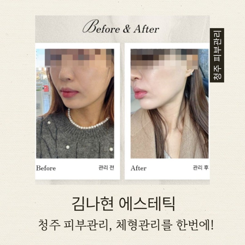 청주 윤곽관리 체형관리 제대로 찾았다, 김나현 에스테틱 림프순환 수기관리 후기