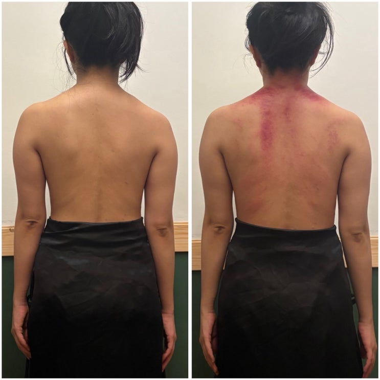 부산웨딩관리 서면신부관리 서면웨딩관리 : 카리언뷰티클리닉