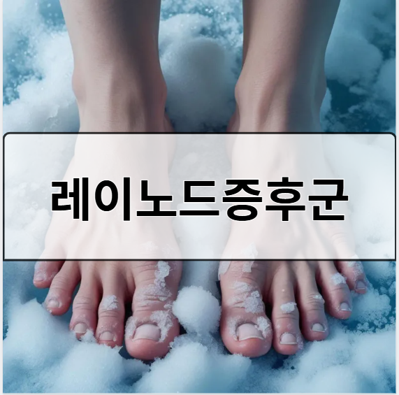 레이노드증후군 증상 원인 관리법 총정리