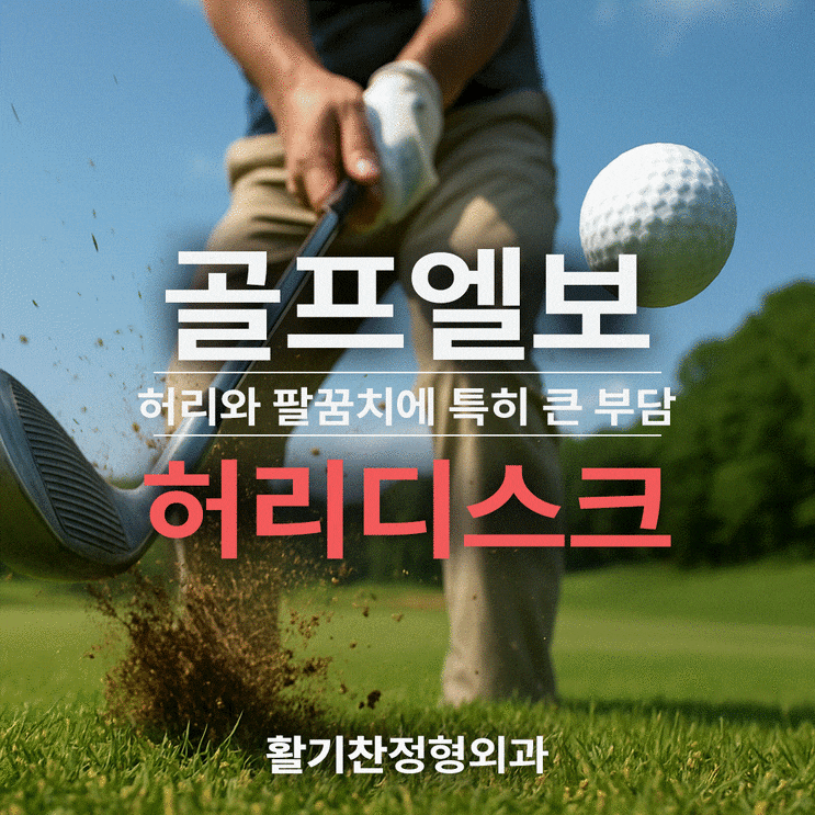  연신내팔꿈치통증, 골프 스윙 후 생긴 통증예방법