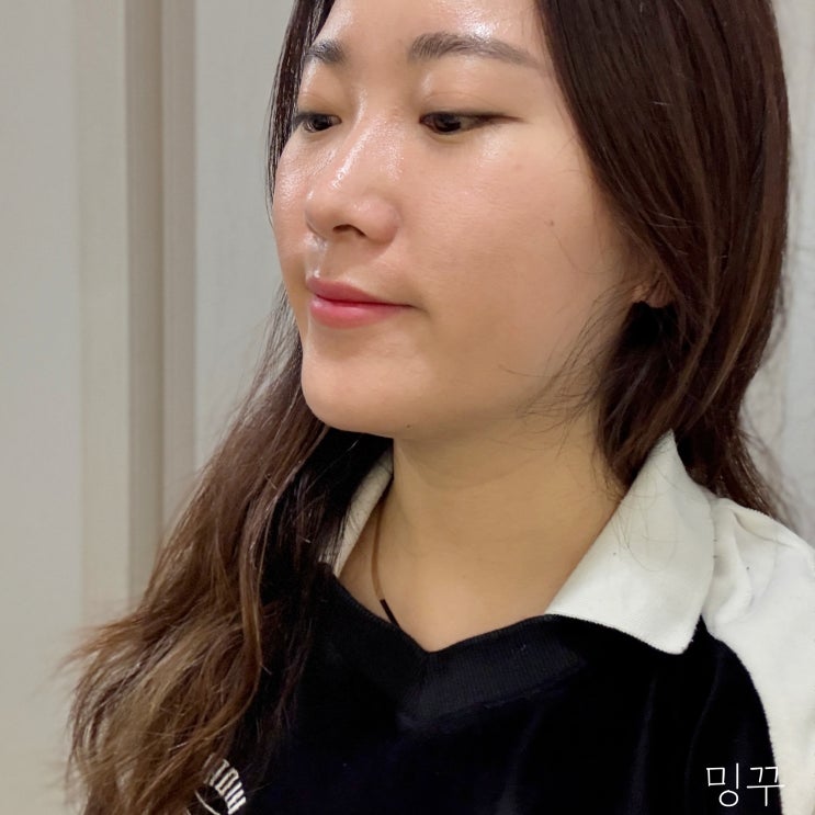 파주 성형외과 텐써마 300샷 통증 효과 관리주기 올리지오 비교