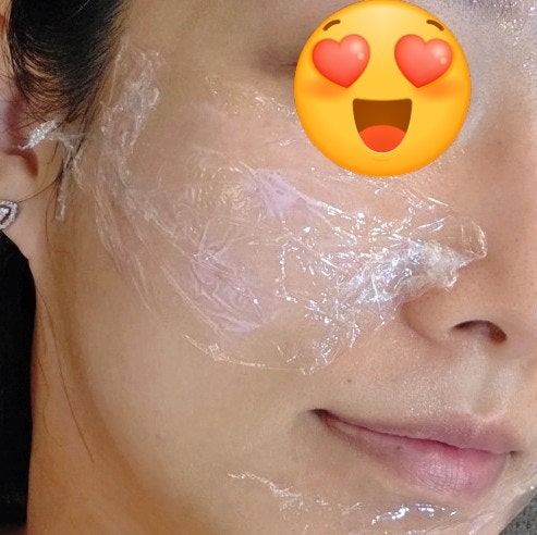  구미 인동 피부관리 브니엘뷰티 멜라싹쓸케어