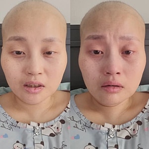 이혼숙려캠프 ‘투병부부’ 안혜림, 블로그·유튜브 폭로에 쏠리는 대중의 시선