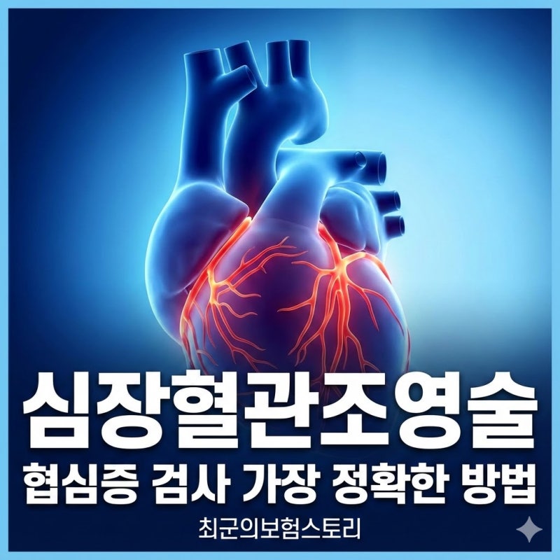 심장혈관조영술 협심증 검사 방법 중 가장 정확한 이유와 진행 과정