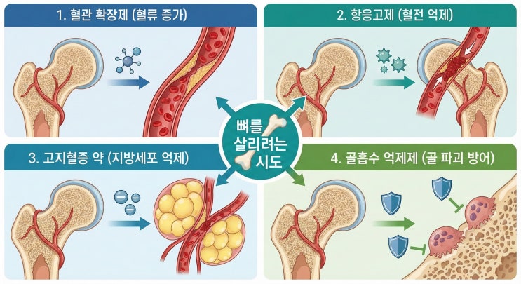  대퇴골두 골괴사 - 비 수술적 치료의 종류와 효과, 정리해드립니다.