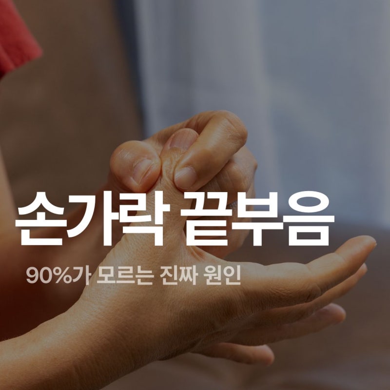 손가락 끝부음, 단순 염증 아닐 수 있다? 90%가 모르는 진짜 원인