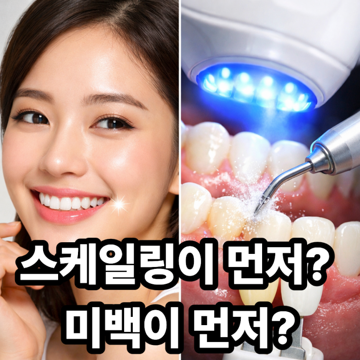  스케일링과 미백, 동시에 해도 될까?｜순서 모르면 효과 반감됩니다