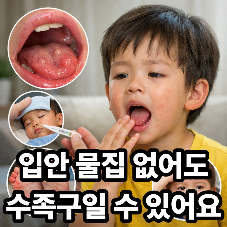   수족구병, 입안 물집이 꼭 생겨야 할까?｜헷갈리는 초기 신호 정리
