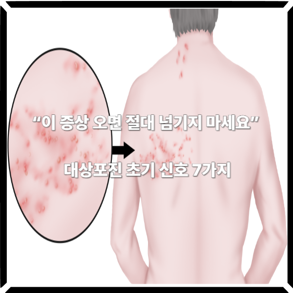  “이 증상 오면 절대 넘기지 마세요” 대상포진 초기 신호 7가지