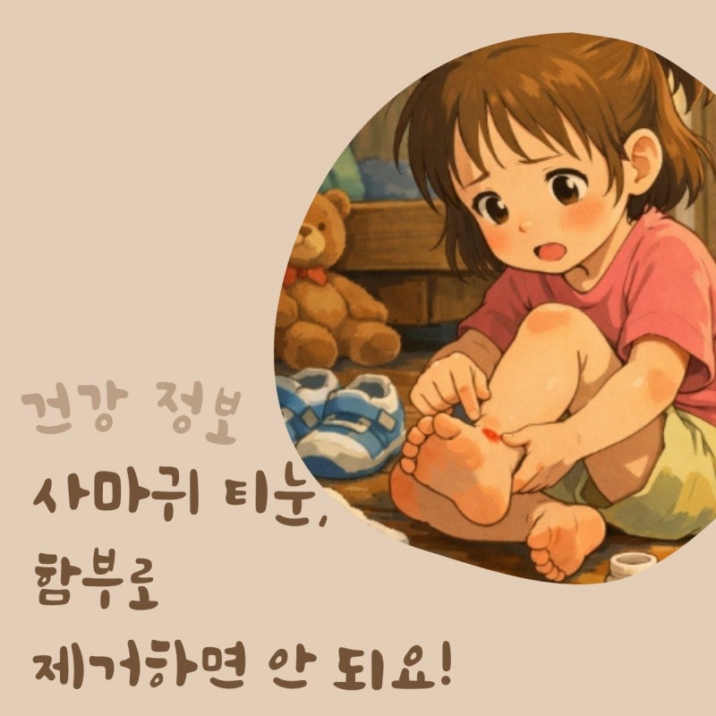 아이 발에 생긴 굳은살 사마귀 티눈 구분법 관리방법