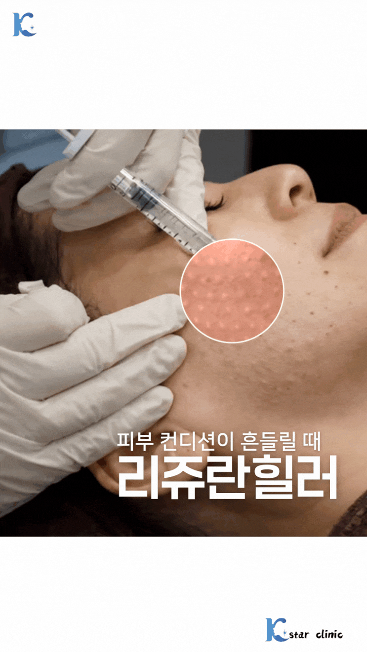  광주스킨부스터 리쥬란 힐러 HB, 피부가 예민할수록 따져봐야 할 점