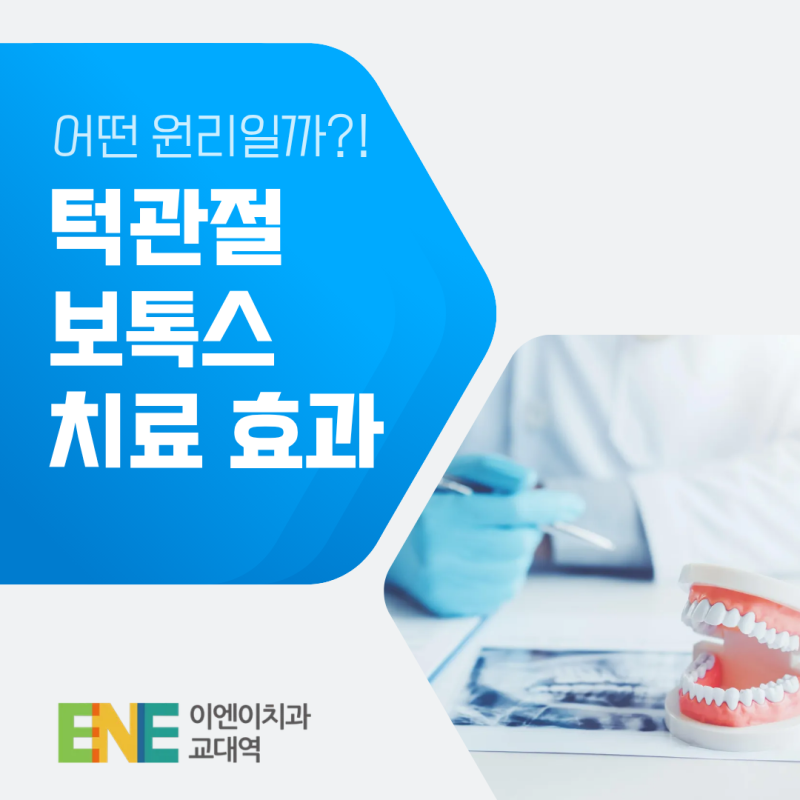 턱관절장애 보톡스 치료 효과 유지 기간, 장단점은?