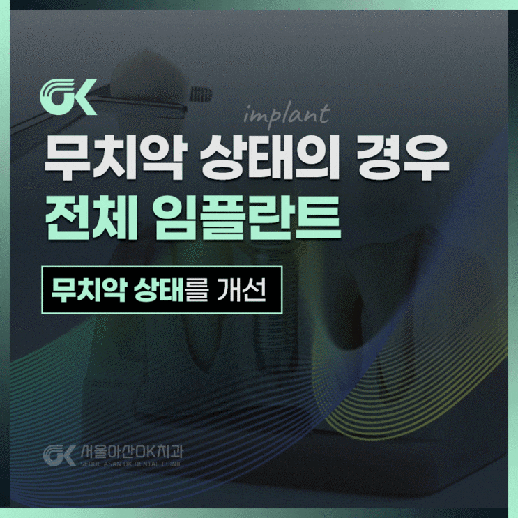  미사역치과, 무치악 상태에 도움이 되는 전체 임플란트