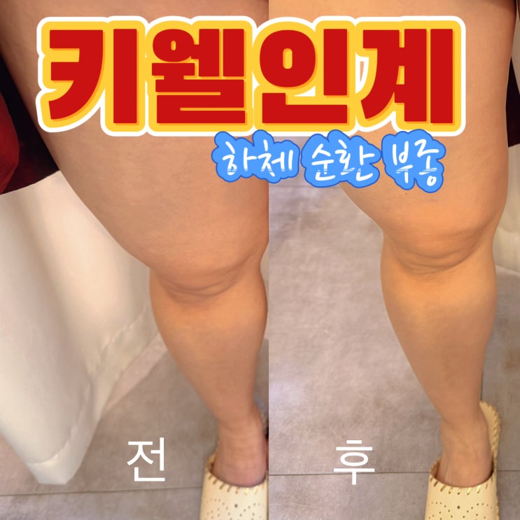  수원 바디 케어 하체 슬리밍 끝판왕 키웰 수원인계점