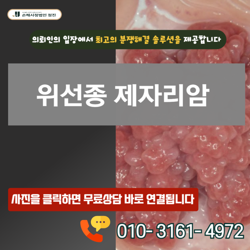 위선종 제자리암, D13.1 양성 코드라도 암진단비 수령 가능한 실무비책