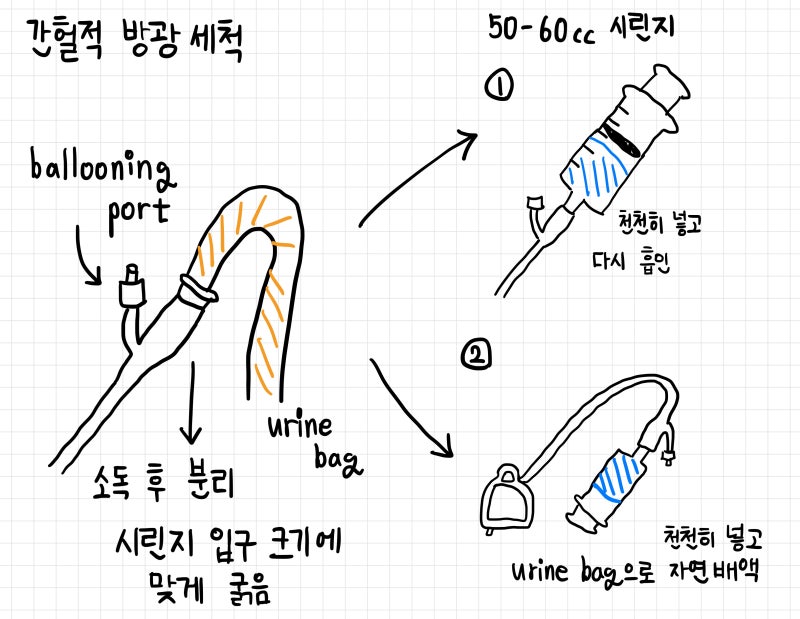 [임상술기] 방광세척 간헐적 intermittent 지속적 continuous Bladder Irrigation 정의 적응증 절차 차이....