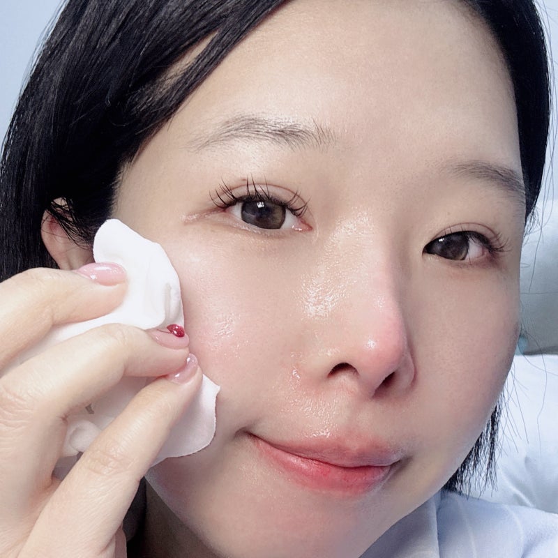 코나피딜 세멘시트 가방 비반콴트망카 로션 조합 피부 예민할 때 이렇게 관리했어요