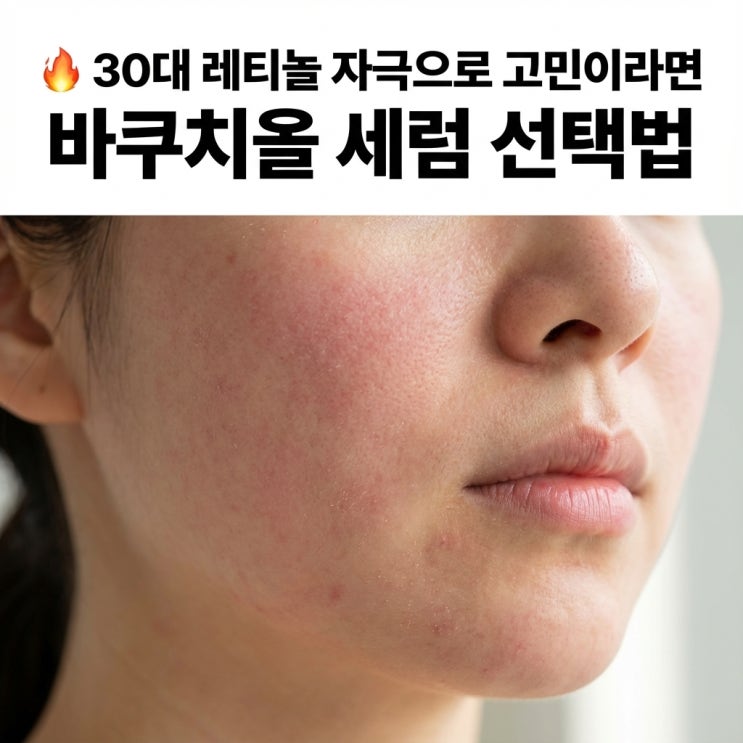   30대 레티놀 자극으로 고민이라면 | 바쿠치올 세럼 선택법