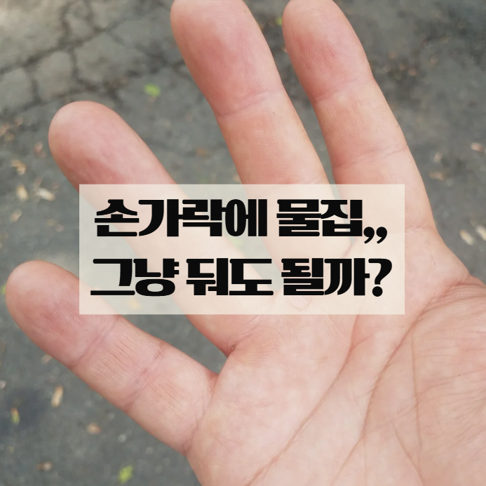  손가락 수포, 그냥 두면 안 되는 이유