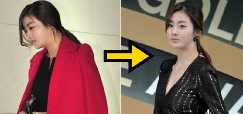 거북목 구부정 자세 싹 고치고 이미지 완전 바뀐 강소라
