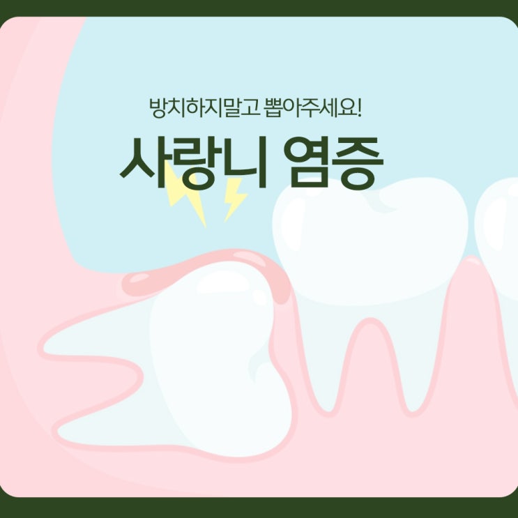  사랑니 염증, 방치하지말고 뽑아주세요!