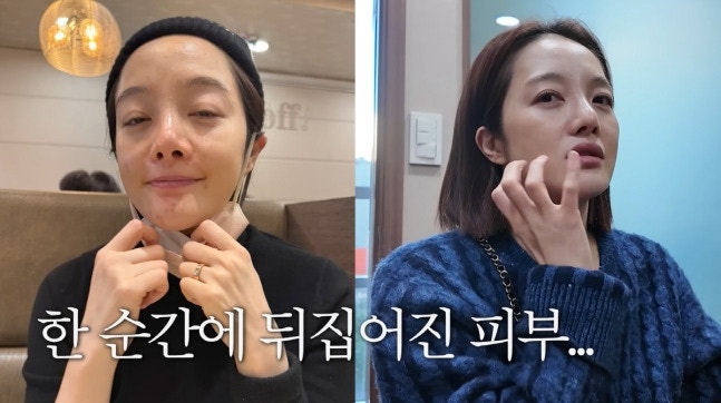 황보라 42세, 출산 후 주저앉은 얼굴에 충격!