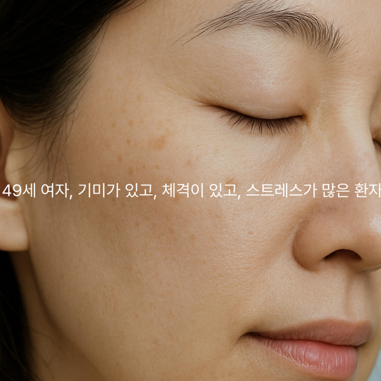  포항 피부관리, 기미 잡티 색소에 한약과 침치료법은 무엇인가?