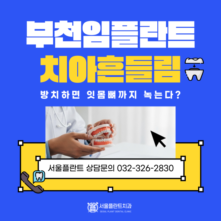 부천 임플란트 잘하는 치과 치아 흔들림 방치하면 잇몸뼈까지 녹는다?