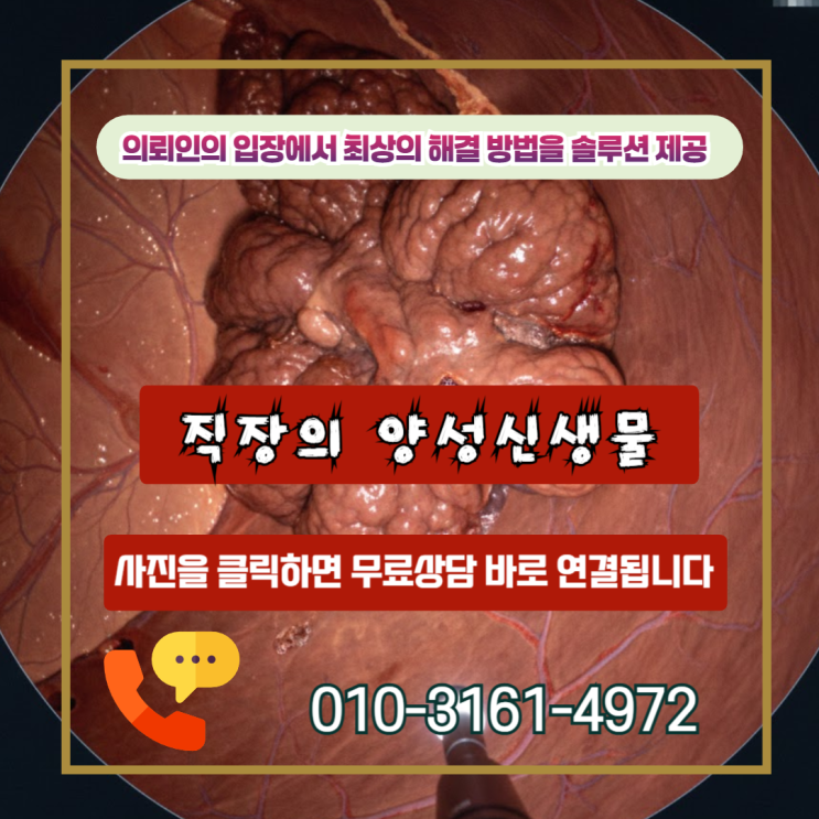  직장의 양성신생물 암진단비 D12.8 진단서 뒤에 숨겨진 보험금의 진실