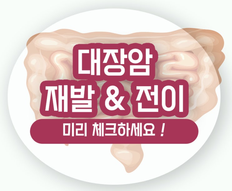  대장암 재발 전이 부위 시기와 예후 예방법 알아보기