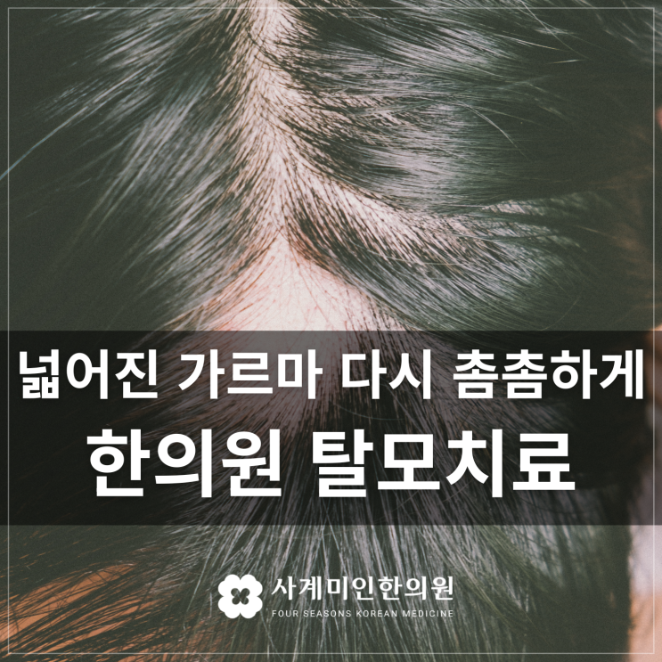  분당한의원 | 넓어진 가르마 다시 촘촘하게, 한의원 탈모치료