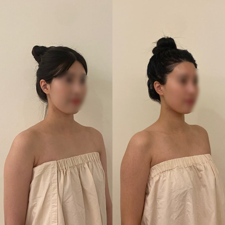  달서구 신부관리 진천동 웨딩 결혼식 전 몸부터 바로잡는 보니예