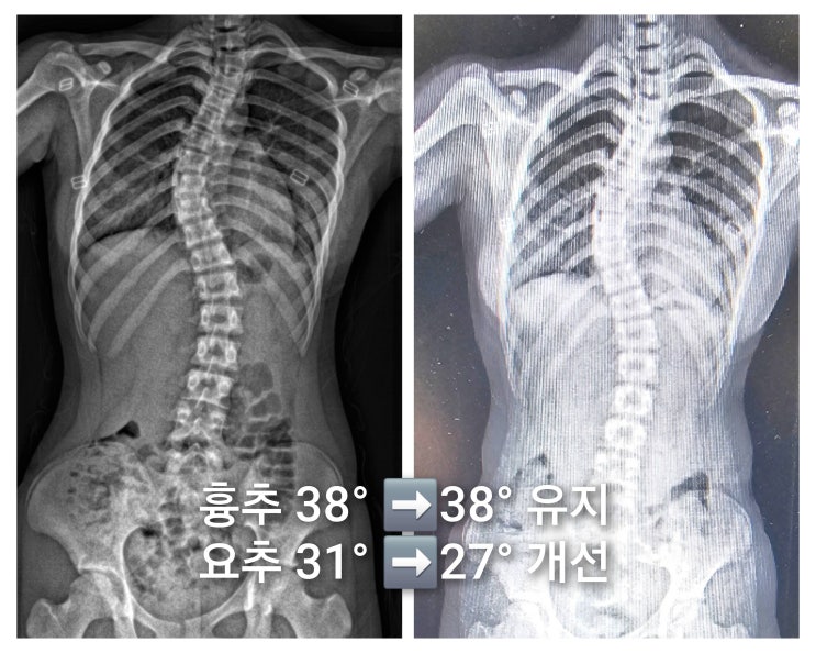  김해 필라테스 성장기 아이들에게 왜 지금 운동이 필요할까요?