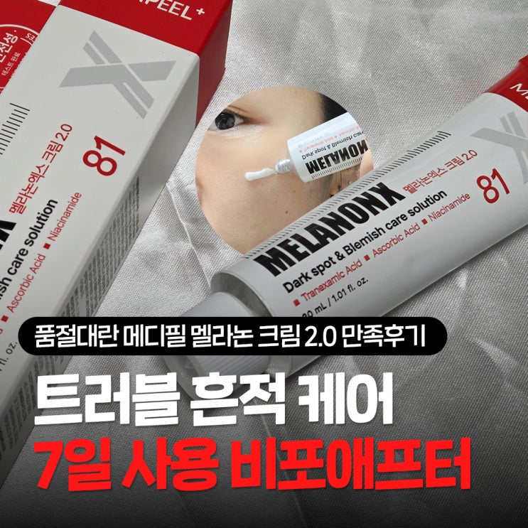 품절대란 메디필멜라논크림 2.0, 트러블 흔적 7일동안 사용한 비포애프터 후기